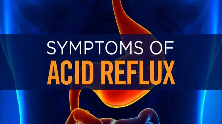 Acid Reflux