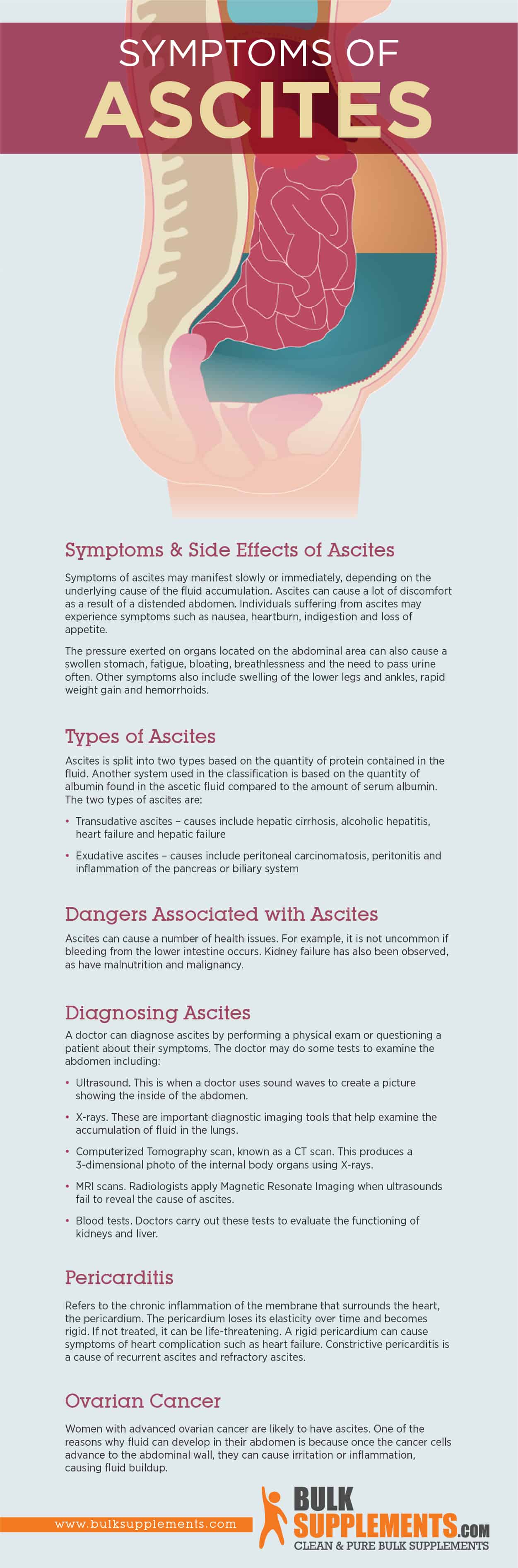 Ascites Symptoms