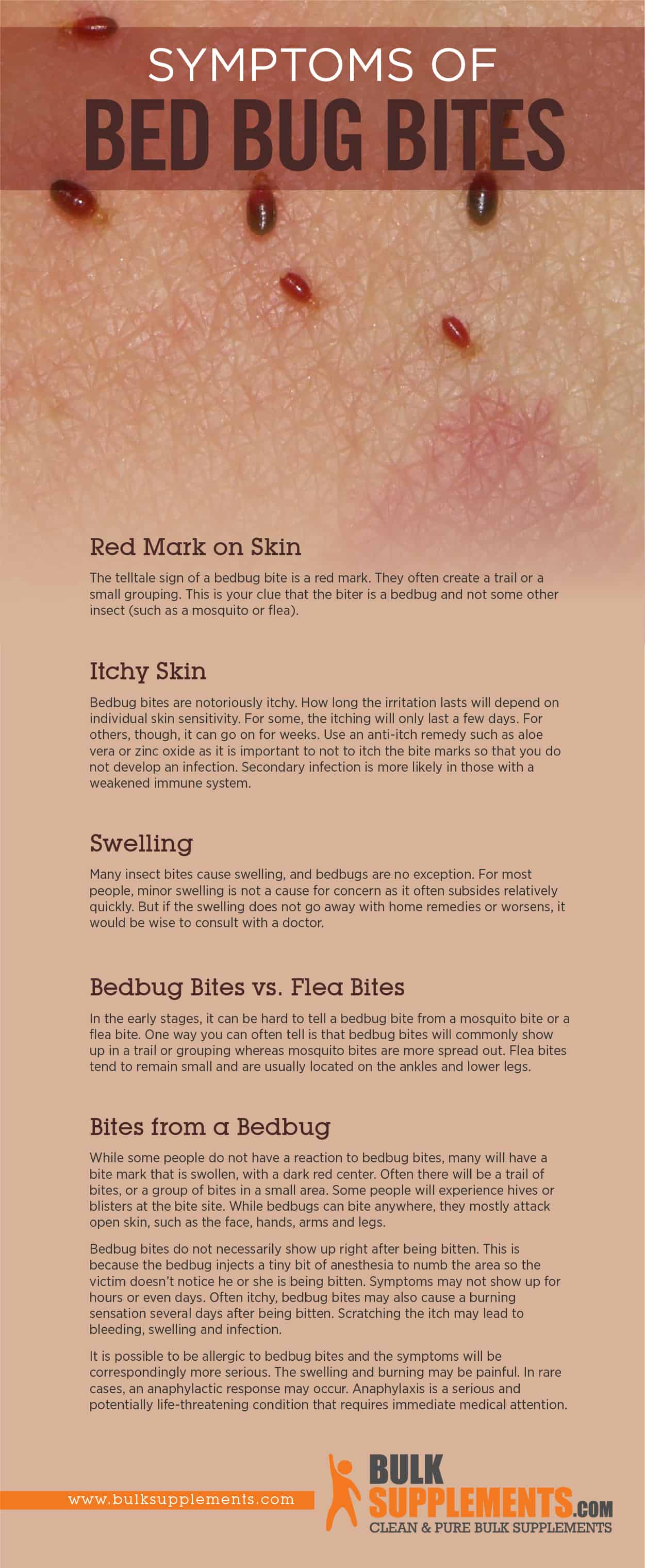 Bed Bug Bites Symptoms