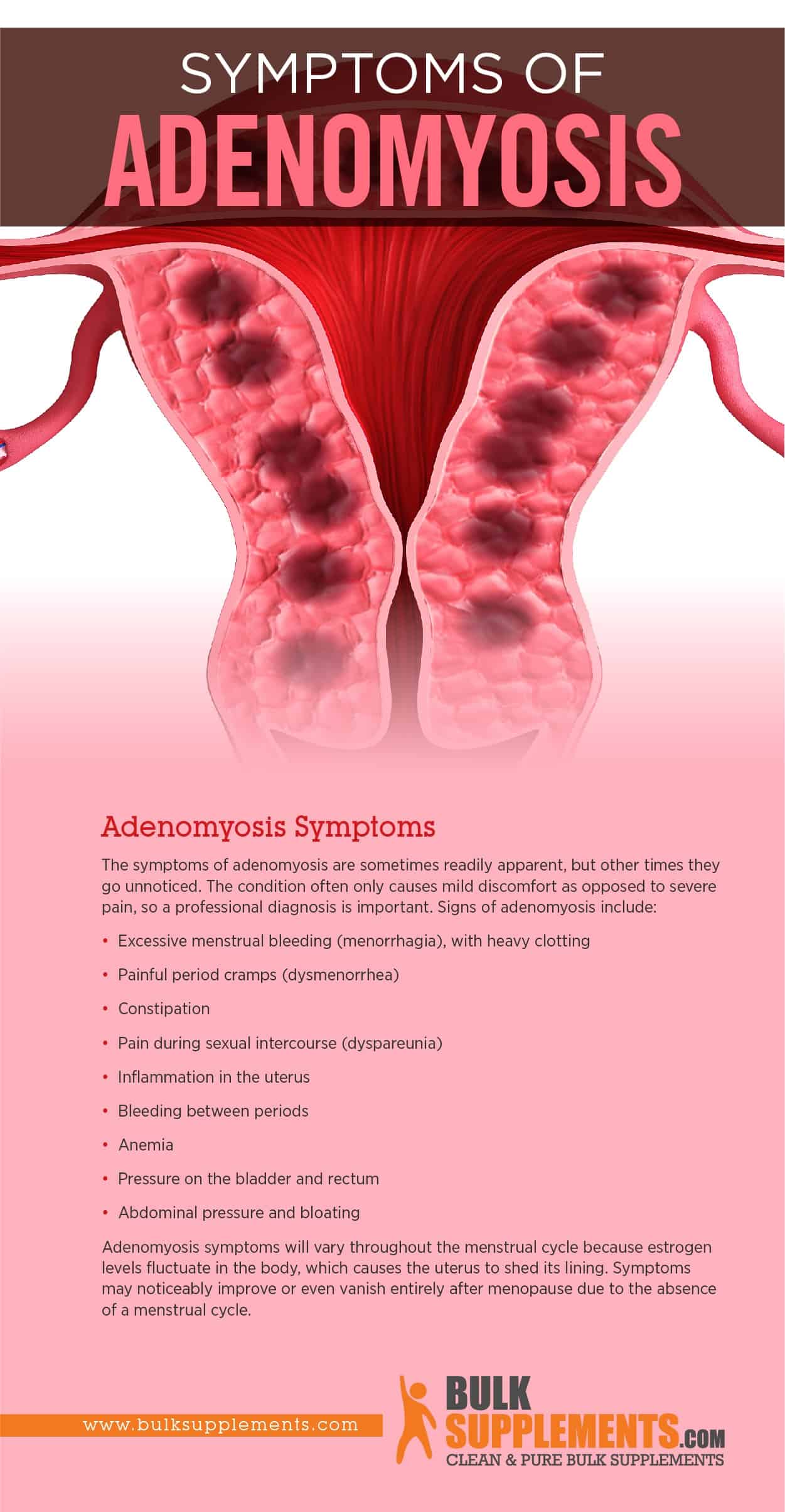 Adenomyosis Symptoms