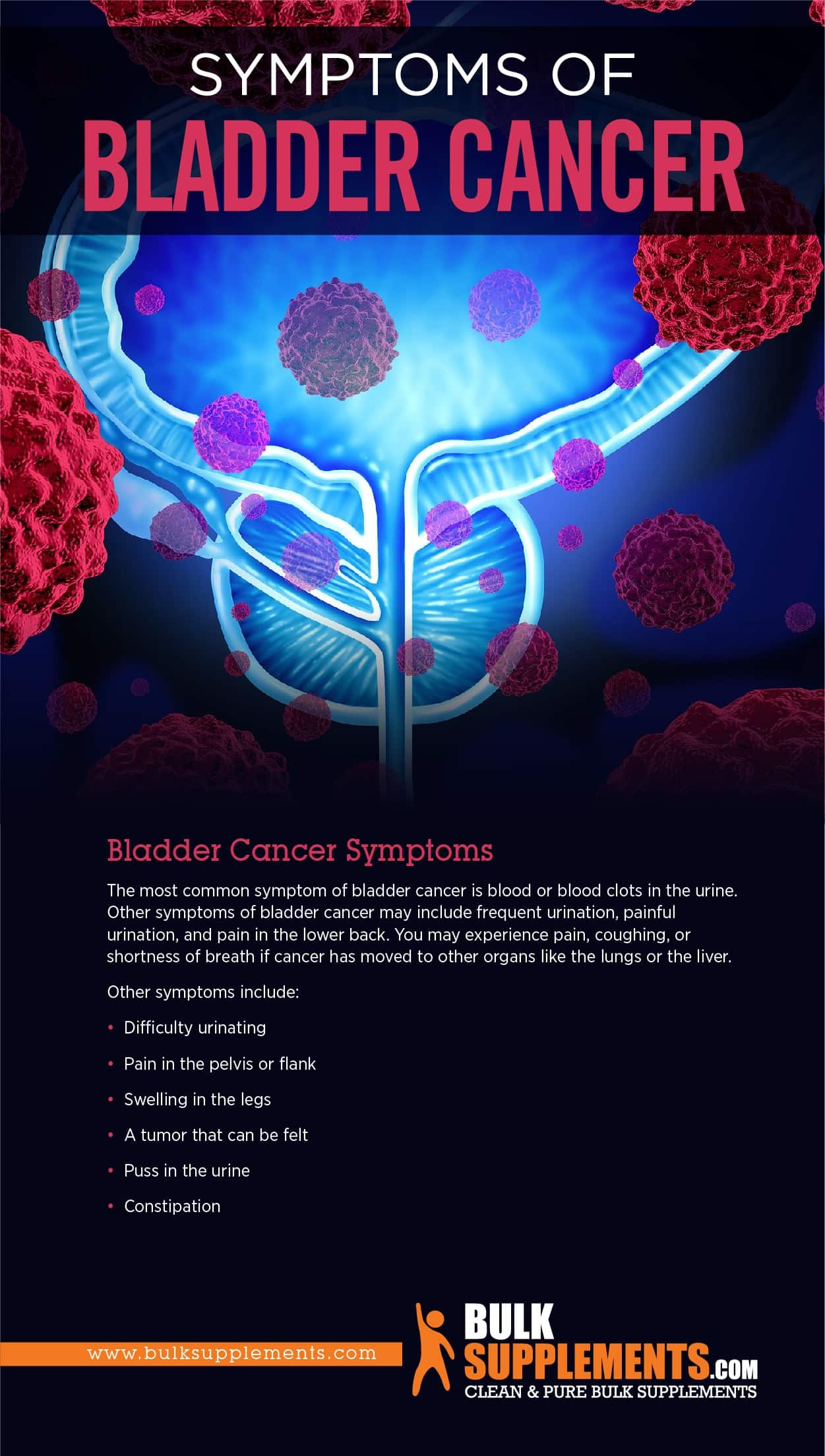 Bladder Cancer Symptoms