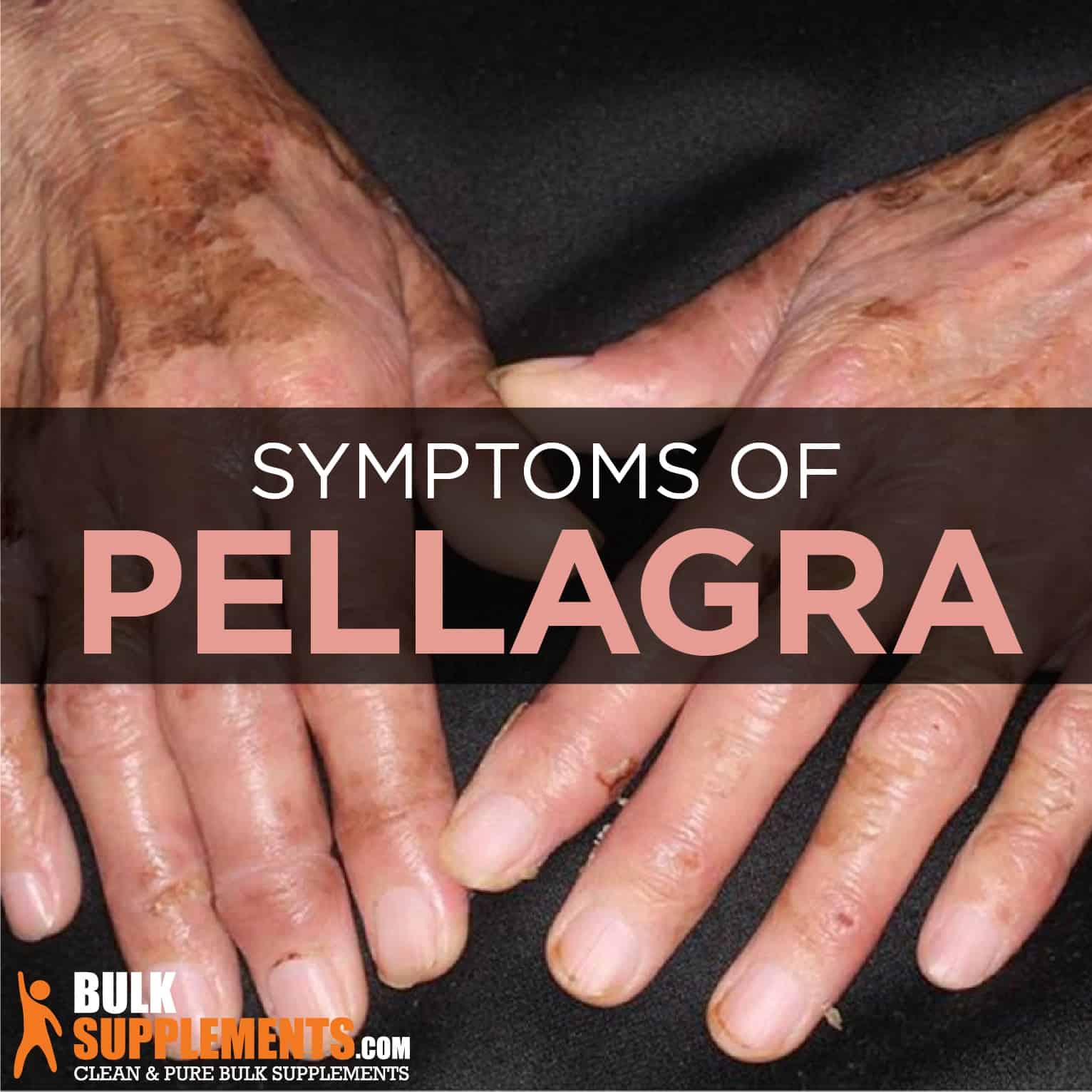 How Does Pellagra Affect The Body