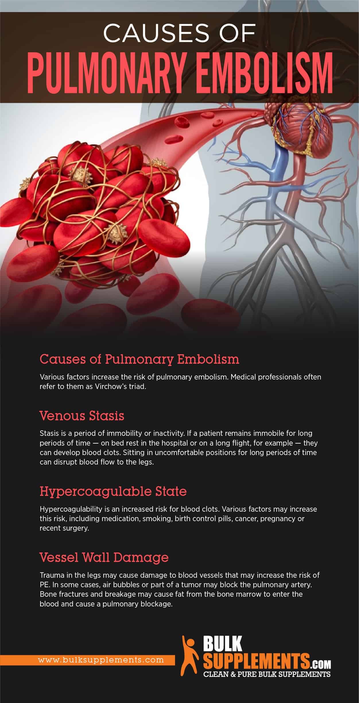 Causes of Pulmonary Embolism