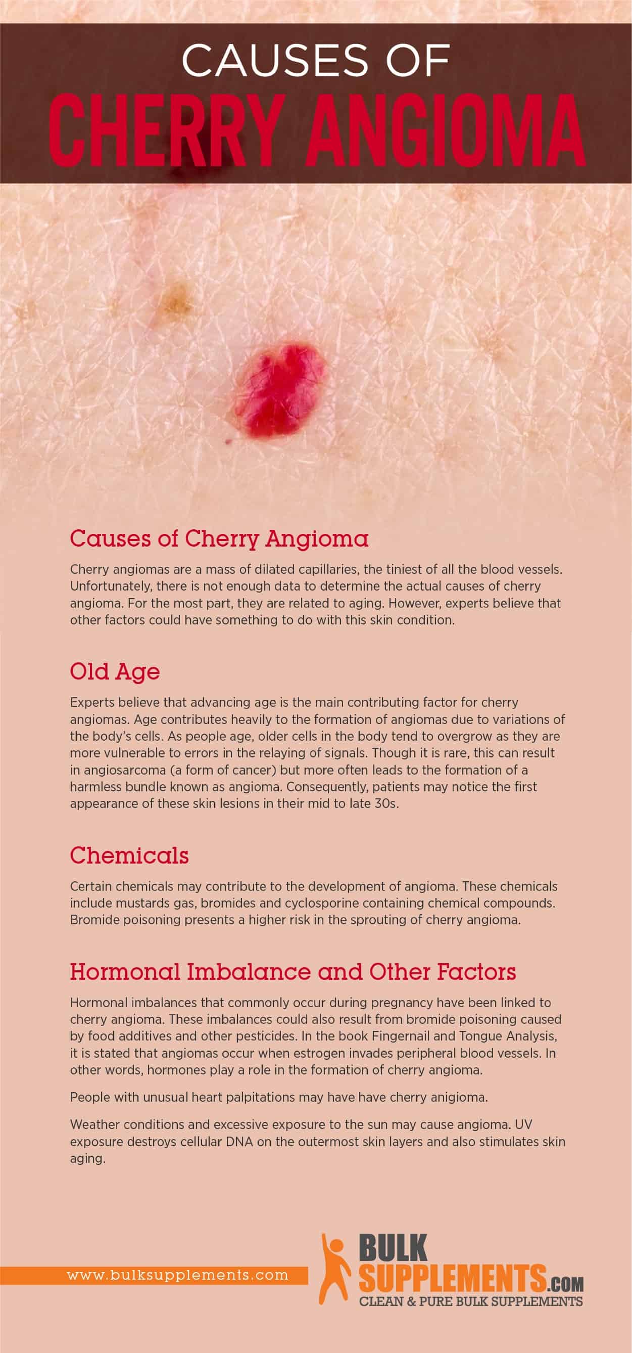 Causes of Cherry Angioma